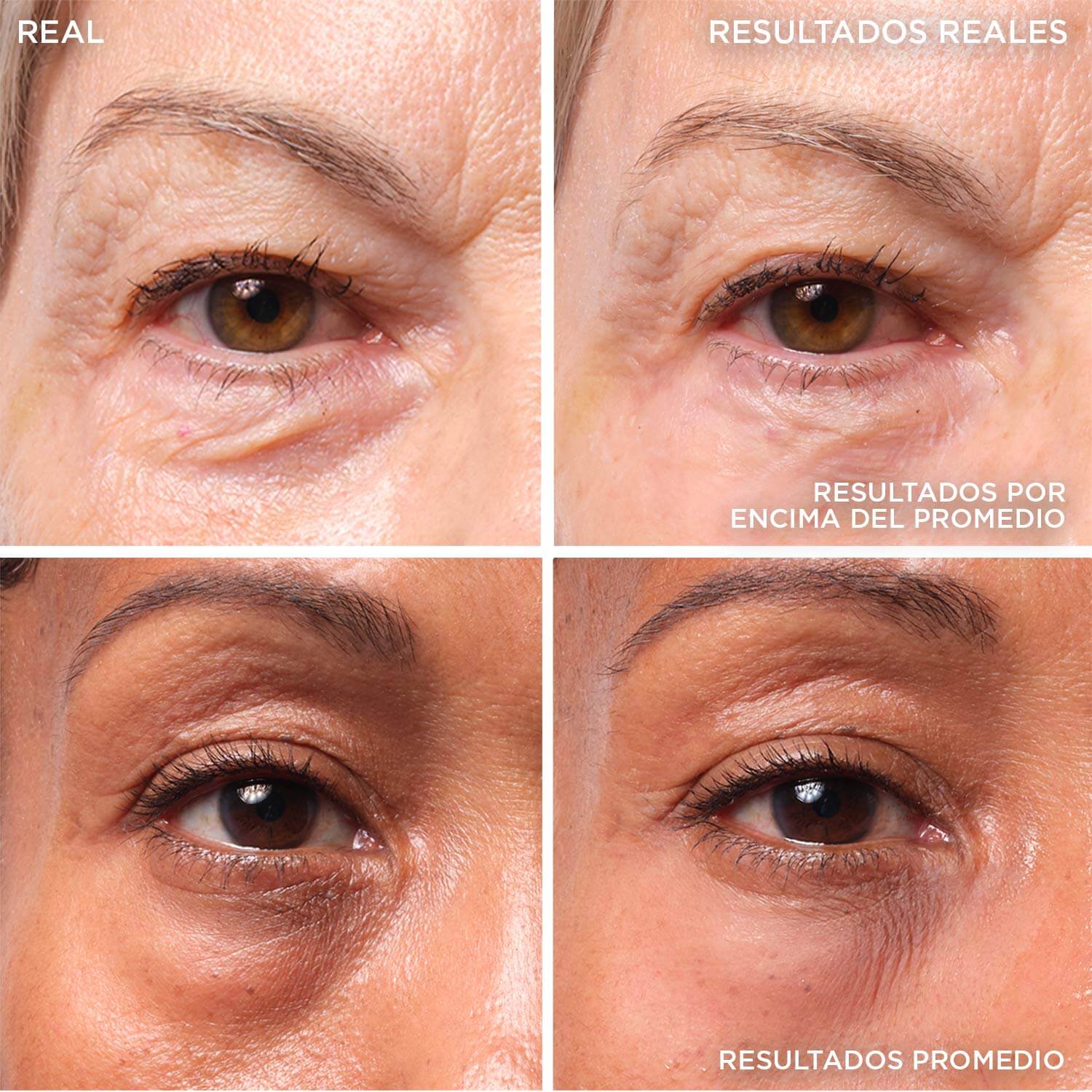 BYE BYE UNDER EYE BAGS (TRATAMIENTO PARA BOLSAS DE OJOS)